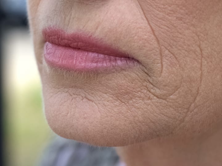 https://www.cosmeticskinclinic.com/wp-content/uploads/smokers-lines-wrinkles.jpg