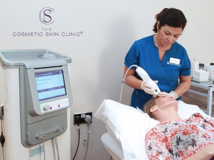 Thermage radio frequency skin tightening Treatment Taking Place