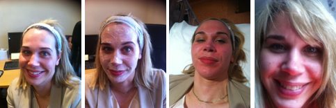 Katherine of TreatmentAdvisor.com reviews Clear+Brilliant at The Cosmetic Skin Clinic Katherine of TreatmentAdvisor.com reviews Clear+Brilliant at The Cosmetic Skin Clinic