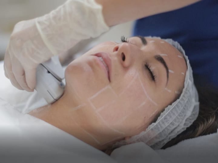 Ultherapy treatment performed on patient