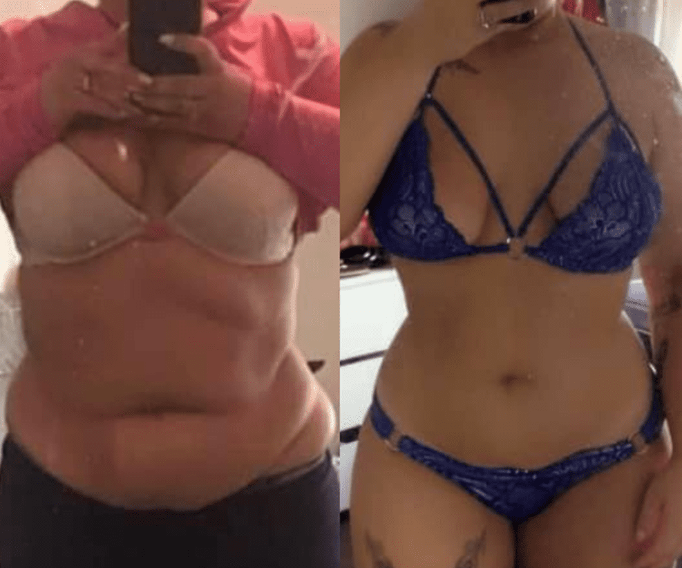 weight loss belly fat before after results, medicated weight loss